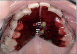 Gresham Orthodontist