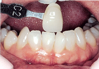 Cosmetic Dentistry Gresham