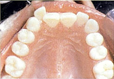 Orthodontist Gresham